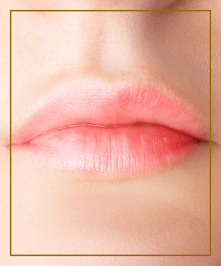 Lip Filler at Miami Wellness and Aesthetics Center in Miami, FL 