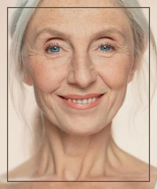 Botox® at Miami Wellness and Aesthetics Center in Miami, FL
