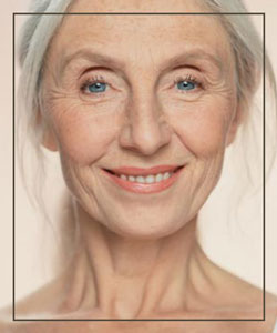 Botox® at Miami Wellness and Aesthetics Center in Miami, FL